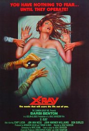 XRay (1981) M4uHD Free Movie
